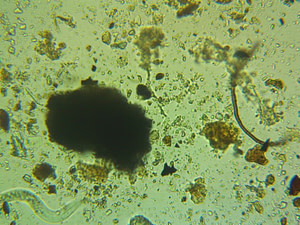 Soil microbe biome, in SymSoil RC under magnification. All Soil Food Web components